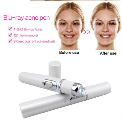 Blue Light Therapy Acne Treatment Device