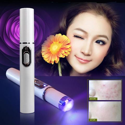 Blue Light Therapy Acne Treatment Device
