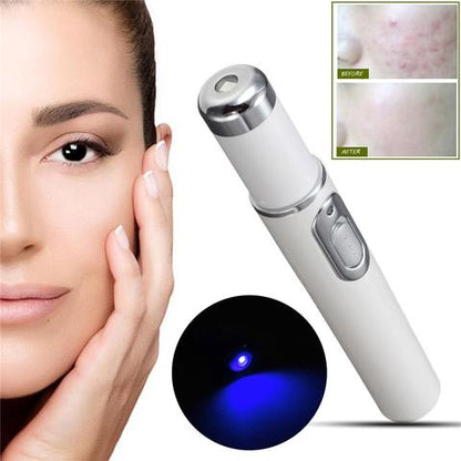 Blue Light Therapy Acne Treatment Device